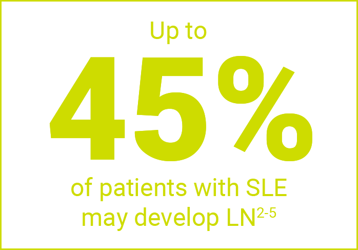 Up to 45% of Patients with SLE May Develop LN